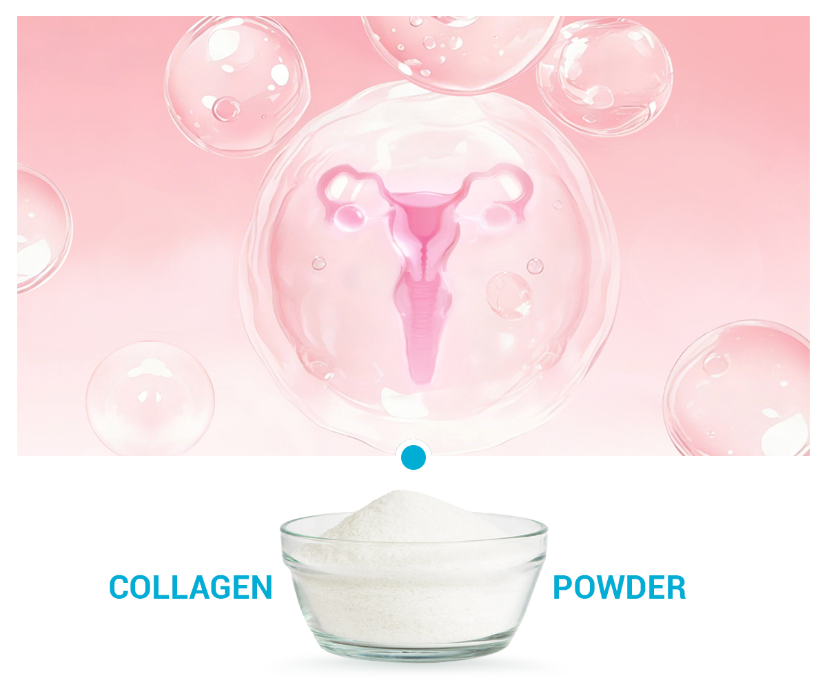 Type VI collagen