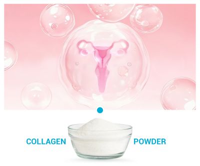Type VI collagen
